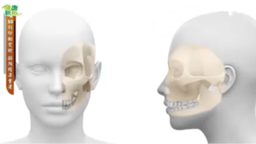 947. 3D列印助变脸-颅颜精准重建