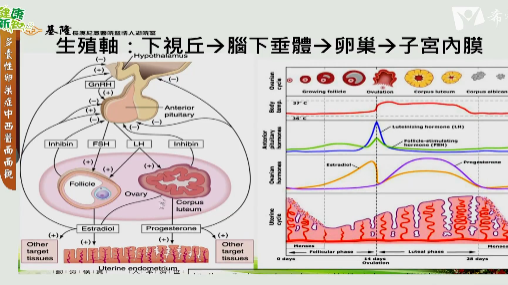 892.多囊性卵巢症中西醫面面觀